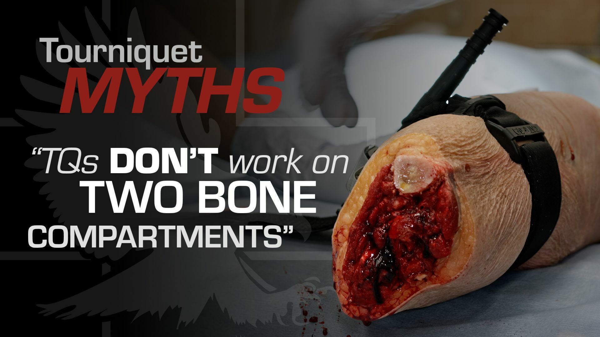 Tourniquet Myths: TQs Don't Work On Two Bone Compartments