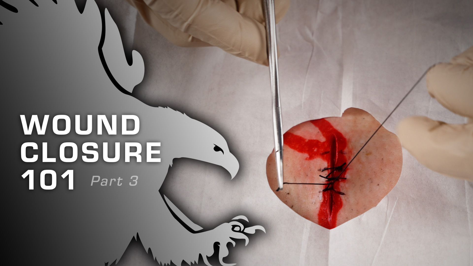 Wound Closure 101 – Learn How to Suture a Wound