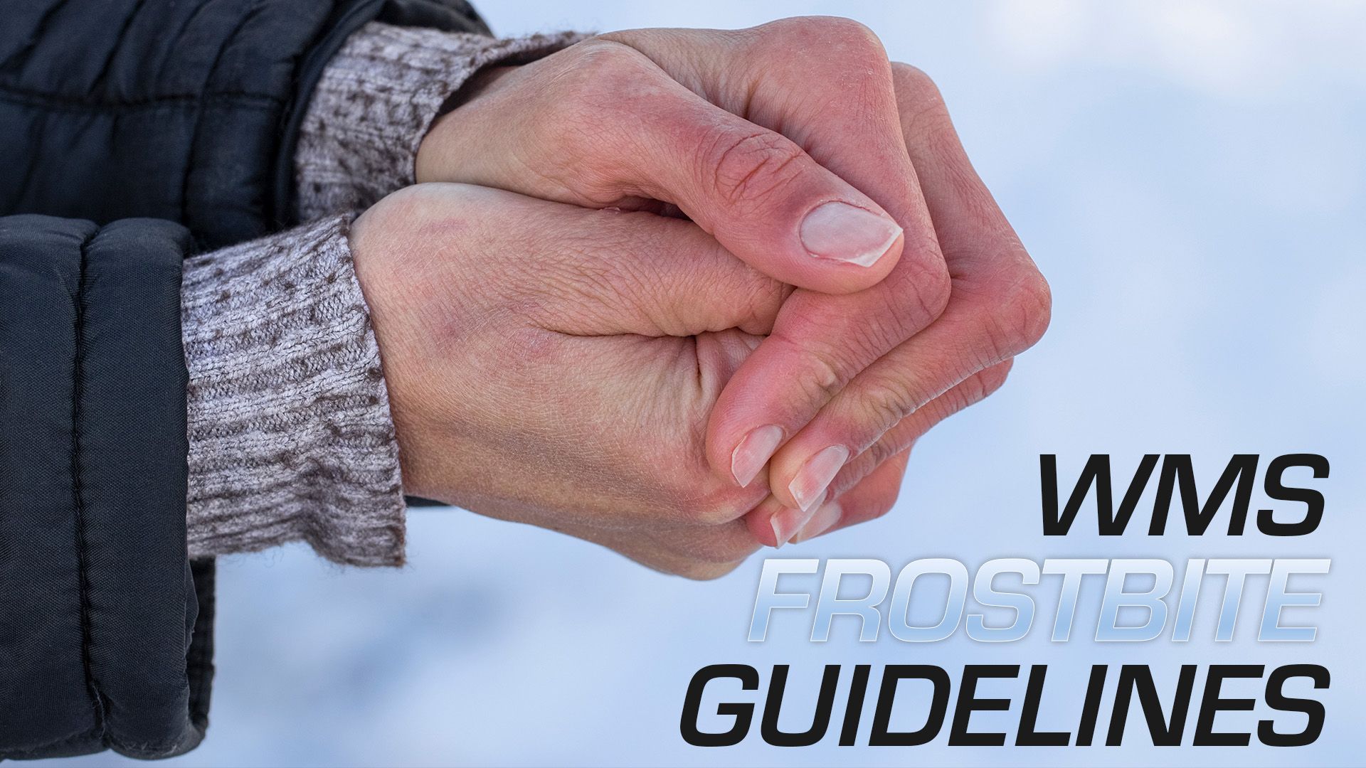 WMS Frostbite Guidelines