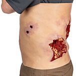 Techline Trauma Wearable Multiple GSW Abdomen