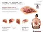 Burn Torso Sim - Prod Info Sheet
