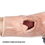 SMRT Task Trainer - Extremity Wound (Versatile Placement)