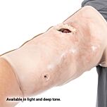 SMRT Task Trainer - Forearm with Gunshot Wound
