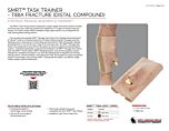 SMRT Task Trainer - Tibia Fracture (Distal Compound) - Product Information Sheet