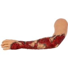 TOMManikin Left Arm w/ Burns