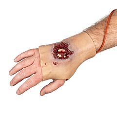 Techline Trauma Wearable GSW Hand Wound (Right)