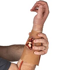 Techline Trauma Wearable Compound Fracture Arm