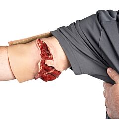 Techline Trauma Wearable GSW Bicep 