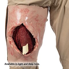 SMRT Task Trainer - Femur Fracture