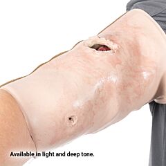 SMRT Task Trainer - Forearm with Gunshot Wound