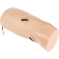 Hemoresponse Bleeding System