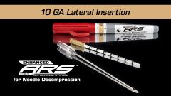 Enhanced ARS - 10 GA Lateral Decompression Video