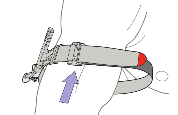 Insert the injured limb through the loop in the band
