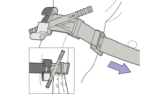 Pull band tightly all the way around the limb